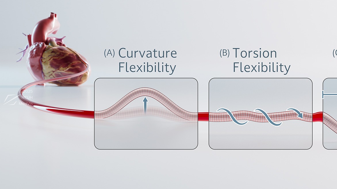Dynamic Change of Coronary Artery Geometry After Bioadaptor Implantation